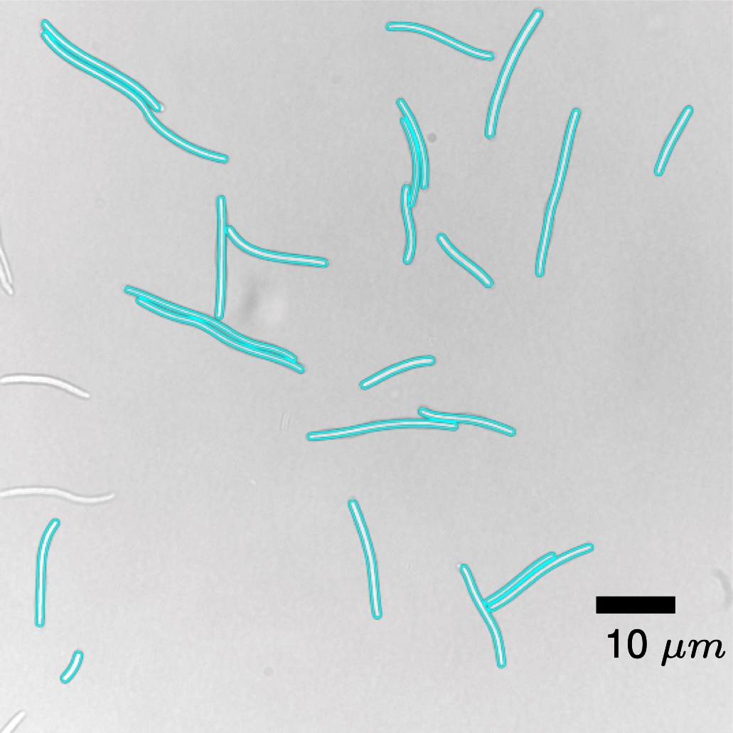 Microscopy image of filamented Escherichia coli, each cell outlined in cyan by the segmentation, with a 10 micrometre scale bar.